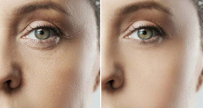Frequency Separation for Skin Retouching